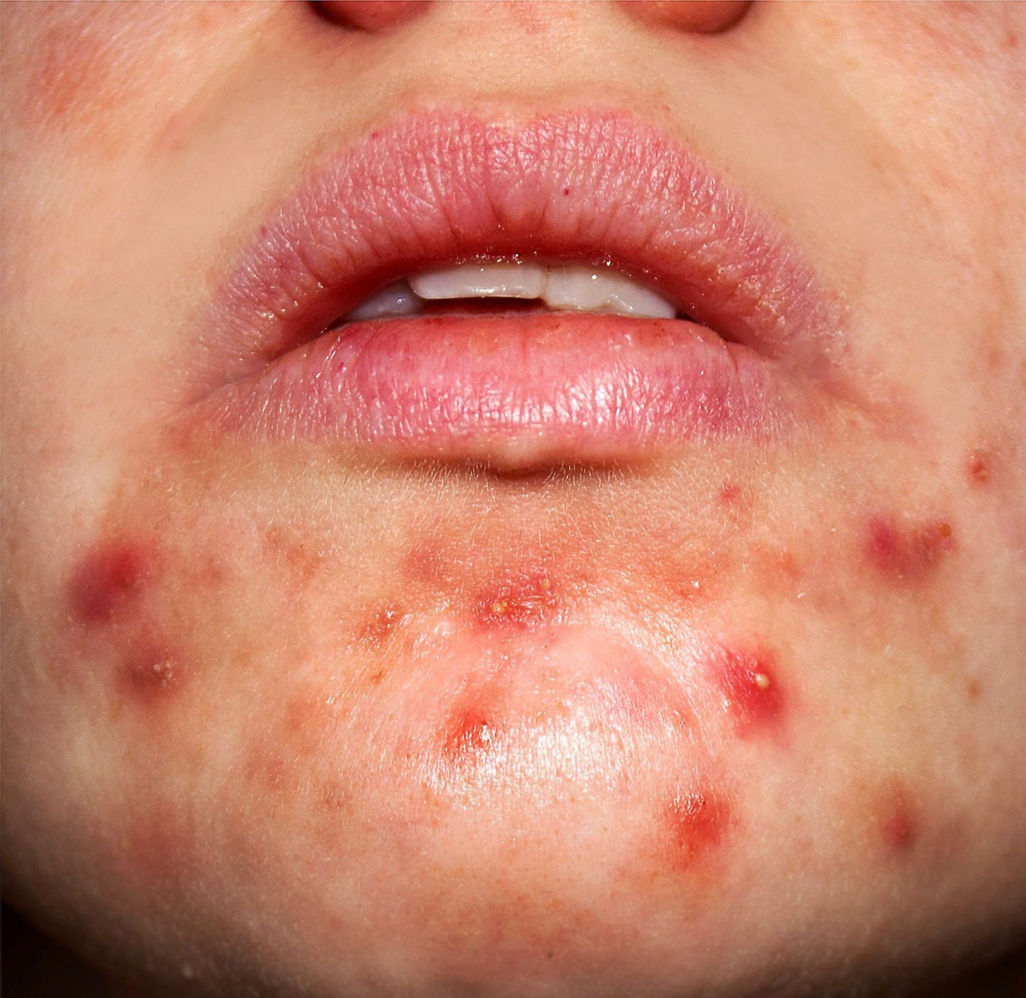 Blue Copper Peptide Serum GHK-Cu