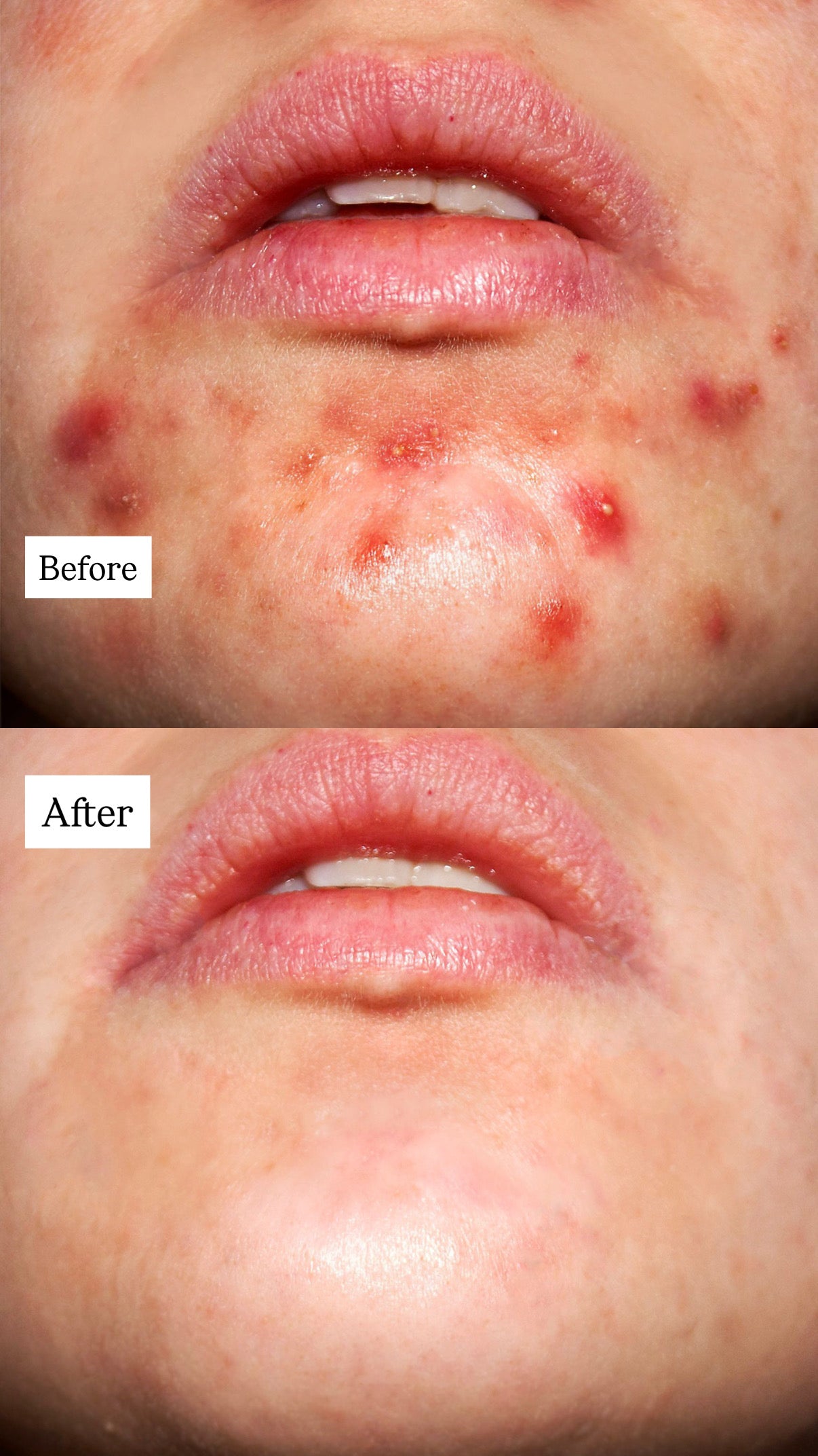 Blue Copper Peptide Serum GHK-Cu